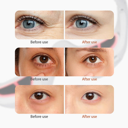 🌟 Revitalize Your Eyes: The Ultimate Red Light Therapy Solution 🌟-EDC