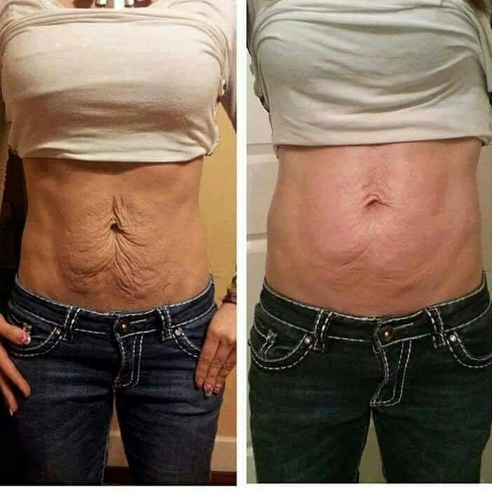 🔥KLENIMORE™ Collagen Oil |⚡Tightens and lifts sagging skin by 98% within 24 hours