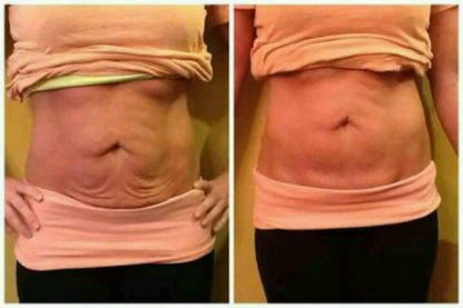 🔥KLENIMORE™ Collagen Oil |⚡Tightens and lifts sagging skin by 98% within 24 hours