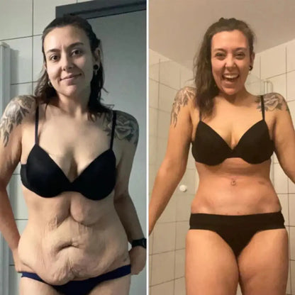 🔥KLENIMORE™ Collagen Oil |⚡Tightens and lifts sagging skin by 98% within 24 hours