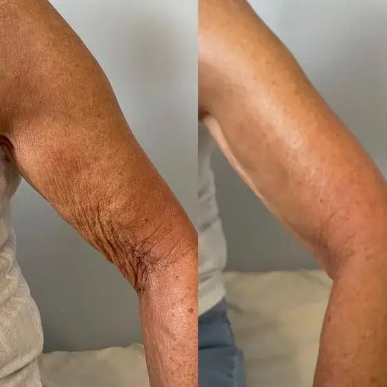 🔥KLENIMORE™ Collagen Oil |⚡Tightens and lifts sagging skin by 98% within 24 hours