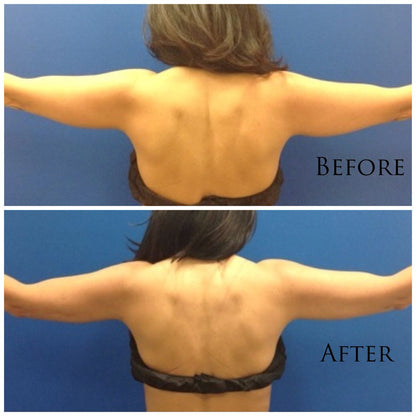 🔥KLENIMORE™ Collagen Oil |⚡Tightens and lifts sagging skin by 98% within 24 hours