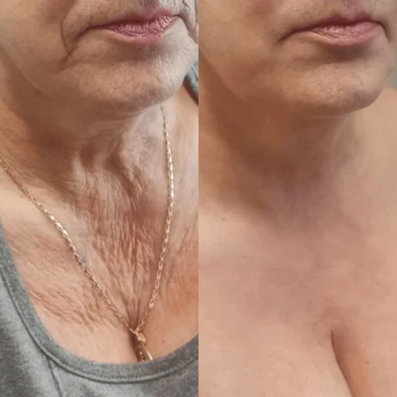 🔥KLENIMORE™ Collagen Oil |⚡Tightens and lifts sagging skin by 98% within 24 hours