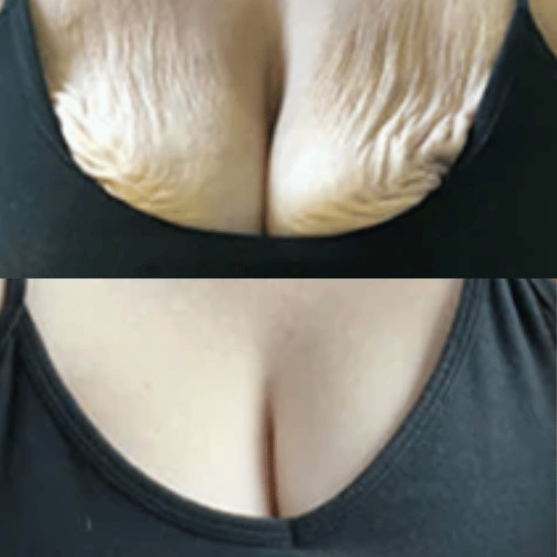 🔥KLENIMORE™ Collagen Oil |⚡Tightens and lifts sagging skin by 98% within 24 hours
