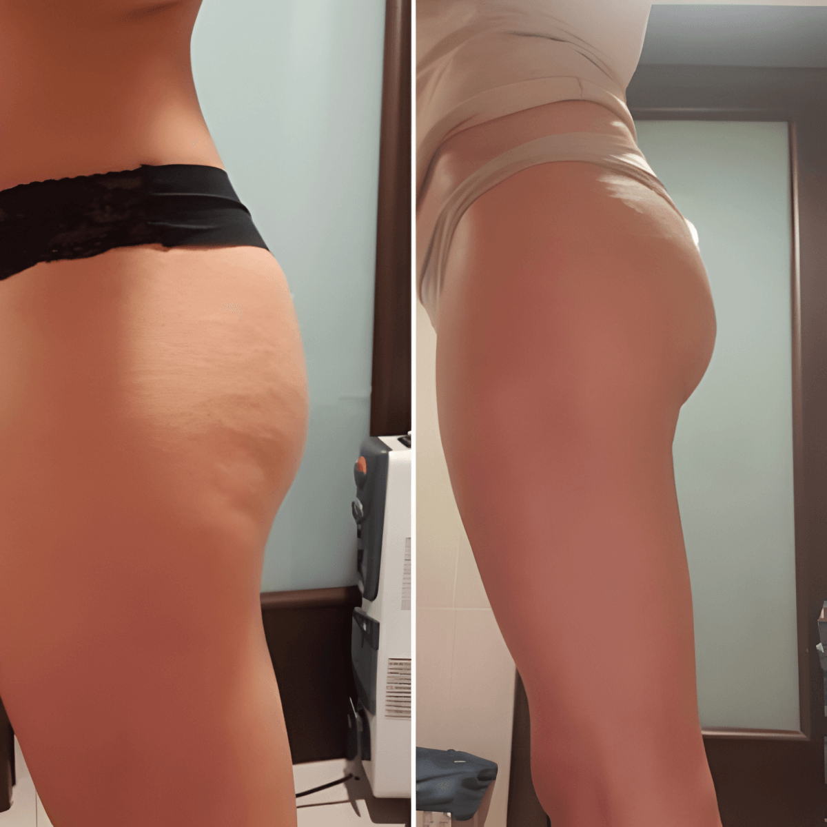 🔥KLENIMORE™ Collagen Oil |⚡Tightens and lifts sagging skin by 98% within 24 hours