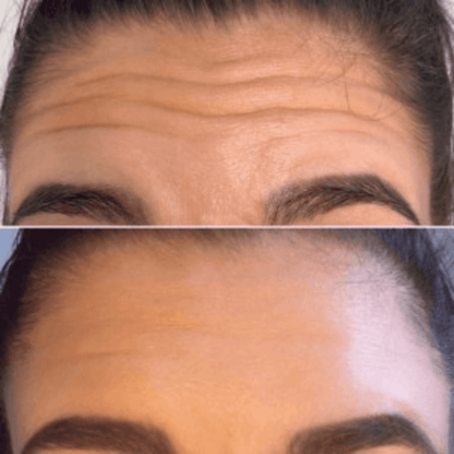 🔥KLENIMORE™ Collagen Oil |⚡Tightens and lifts sagging skin by 98% within 24 hours