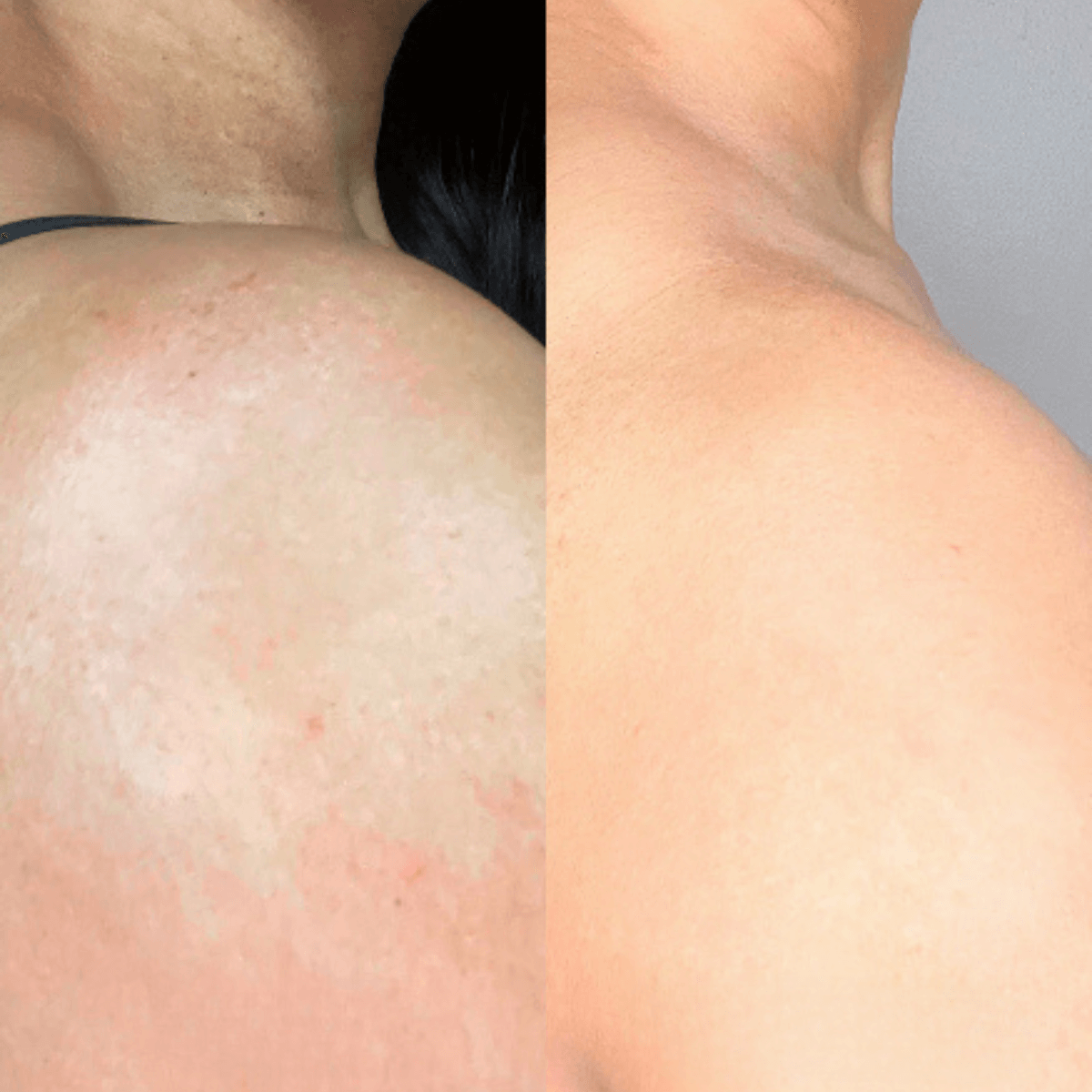 🔥KLENIMORE™ Collagen Oil |⚡Tightens and lifts sagging skin by 98% within 24 hours