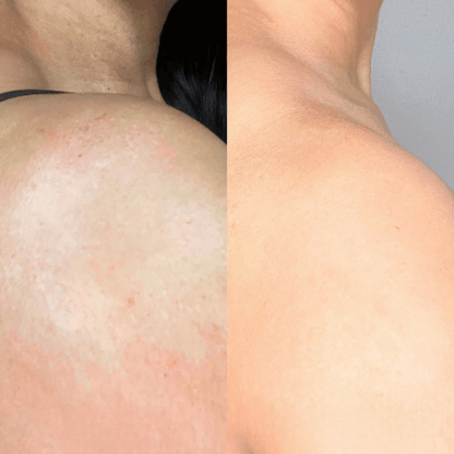 🔥KLENIMORE™ Collagen Oil |⚡Tightens and lifts sagging skin by 98% within 24 hours