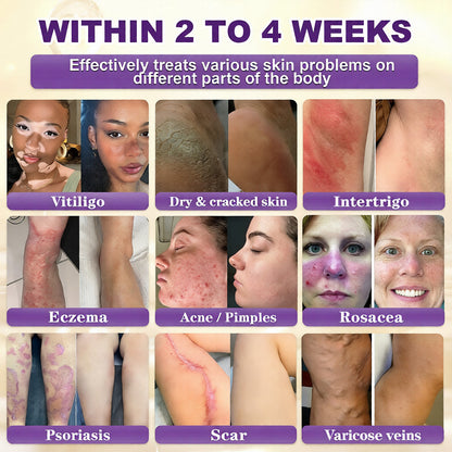 KLENIMORE™ Biotin 10-in-1 Skin Restoration Cream