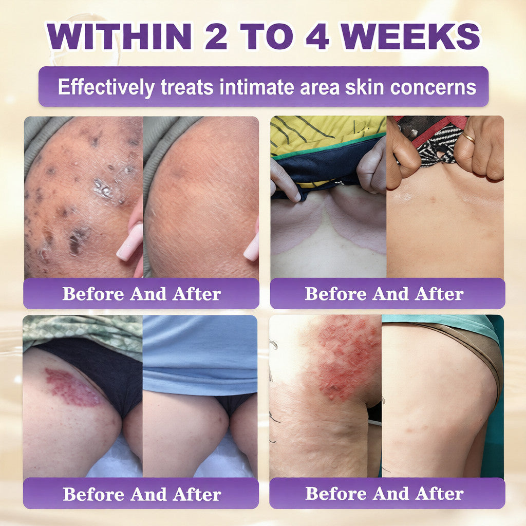 KLENIMORE™ Biotin 10-in-1 Skin Restoration Cream