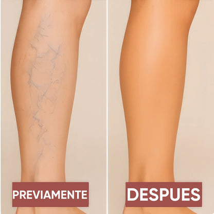 Lumi Legs