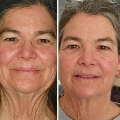 🔥KLENIMORE™ Collagen Oil |⚡Tightens and lifts sagging skin by 98% within 24 hours