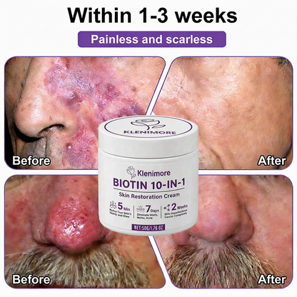 KLENIMORE™ Biotin 10-in-1 Skin Restoration Cream
