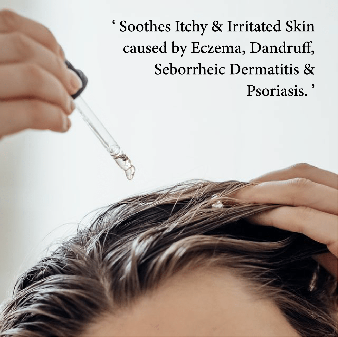🔥 Flash Sale ⏳ Scalp Treatment Serum ✨ Dandruff Relief • Hair Fall Control • Oil Balance 💧 Stronger Hair • Healthier Scalp • Visible Results in Weeks 💪